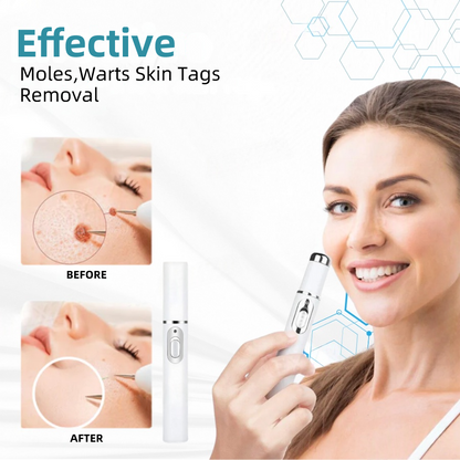 𝐉𝐚𝐬𝐬𝐞𝐞𝐦® Medical-Grade Laser Pen 🔥 (Powered by CO₂ laser technology – effectively removes moles, warts, skin tags, pigmentation spots, and other skin imperfections)🏆
