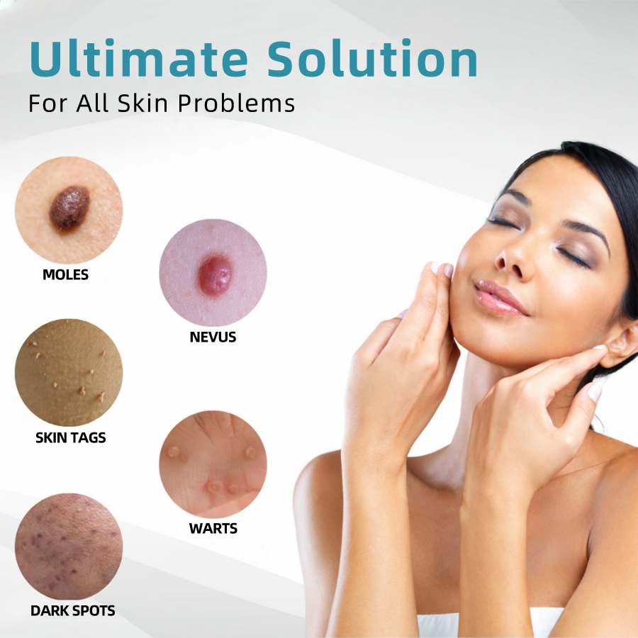 𝐉𝐚𝐬𝐬𝐞𝐞𝐦® Medical-Grade Laser Pen 🔥 (Powered by CO₂ laser technology – effectively removes moles, warts, skin tags, pigmentation spots, and other skin imperfections)🏆