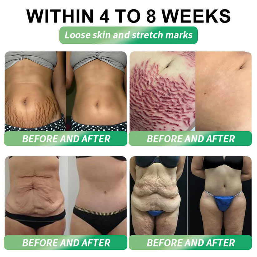 💡𝑶𝒇𝒇𝒊𝒄𝒊𝒂𝒍 𝑺𝒕𝒐𝒓𝒆 | 💯Divifit®US 𝐺𝐿𝑃-𝟏  𝑺𝒊𝒙-𝒊𝒏-𝑶𝒏𝒆 𝑯𝒆𝒂𝒍𝒕𝒉 𝑺𝒐𝒍𝒖𝒕𝒊𝒐𝒏 𝑶𝒓𝒂𝒍 𝑳𝒊𝒒𝒖𝒊𝒅  (𝐉𝐮𝐬𝐭 𝐨𝐧𝐜𝐞 𝐚 𝐝𝐚𝐲, 𝐯𝐢𝐬𝐢𝐛𝐥𝐞 𝐜𝐡𝐚𝐧𝐠𝐞𝐬 𝐢𝐧 𝟕 𝐝𝐚𝐲𝐬） ✅ 𝐅𝐨𝐫 𝐨𝐛𝐞𝐬𝐢𝐭𝐲, 𝐜𝐚𝐫𝐝𝐢𝐨𝐯𝐚𝐬𝐜𝐮𝐥𝐚𝐫 𝐡𝐞𝐚𝐥𝐭𝐡, 𝐝𝐢𝐚𝐛𝐞𝐭𝐞𝐬, 𝐬𝐥𝐞𝐞𝐩 𝐚𝐩𝐧𝐞𝐚, 𝐆𝐮𝐭 𝐇𝐞𝐚𝐥𝐭𝐡, 𝐣𝐨𝐢𝐧𝐭 𝐢𝐬𝐬𝐮𝐞𝐬, 𝐚𝐧𝐝 𝐦𝐨𝐫𝐞