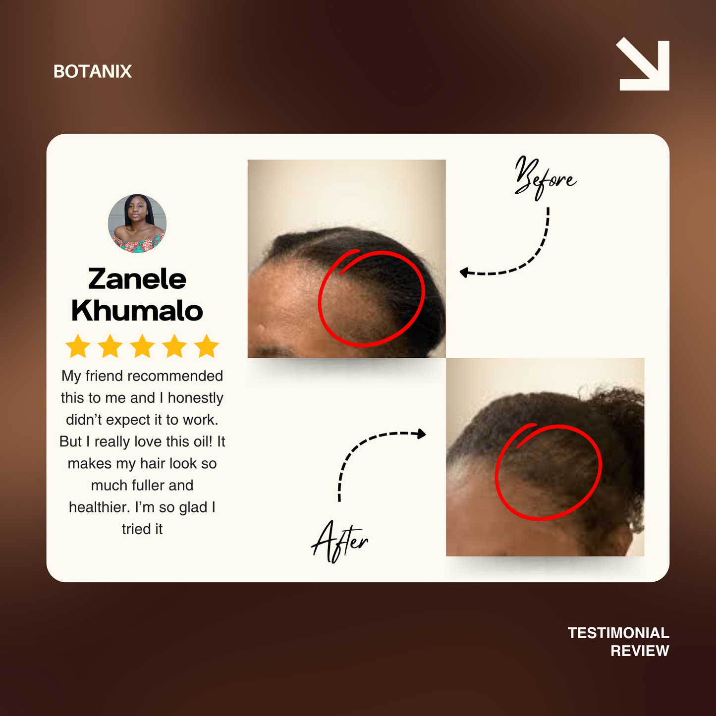 Batana Natural Hair Growth Oil