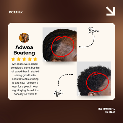 Batana Natural Hair Growth Oil