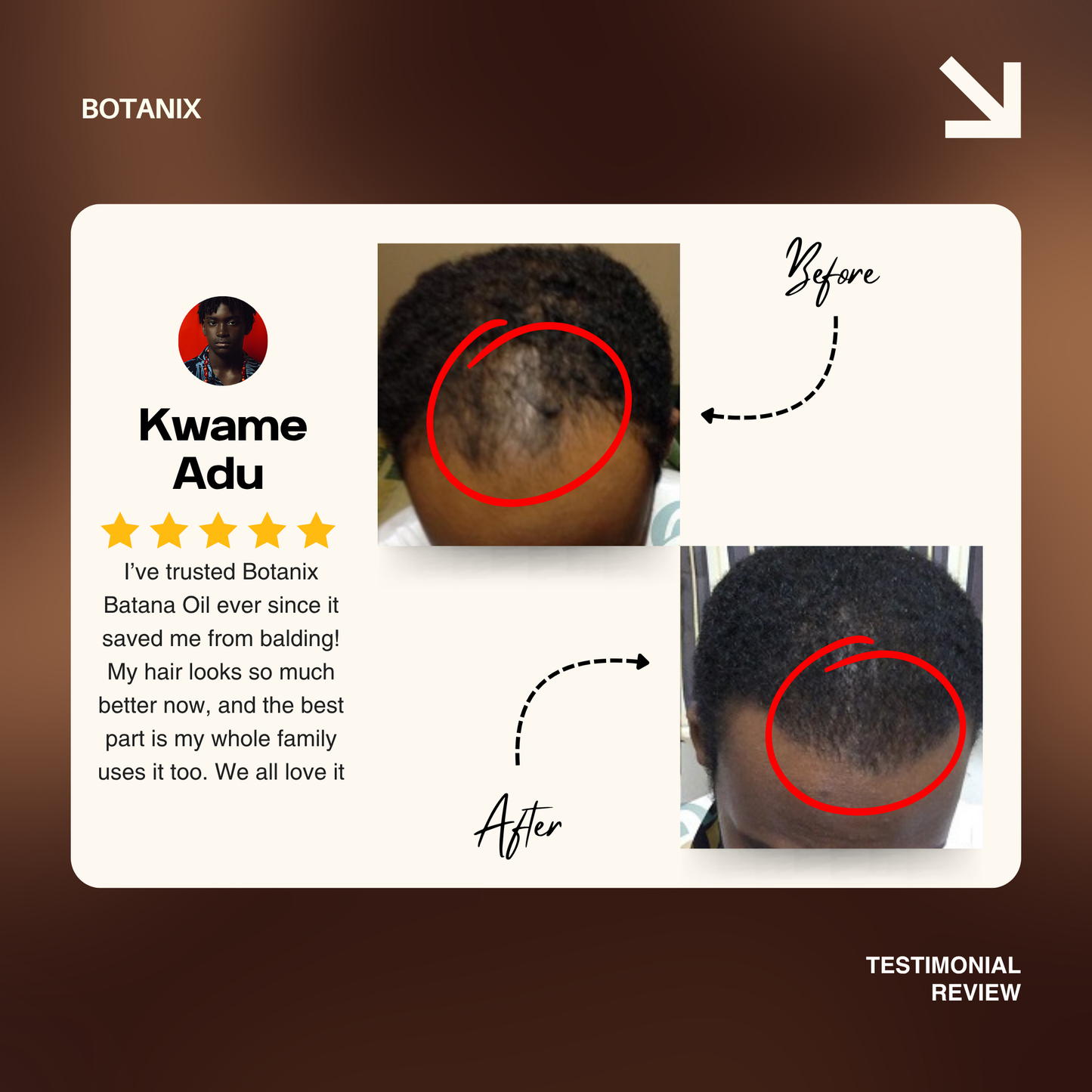 Batana Natural Hair Growth Oil