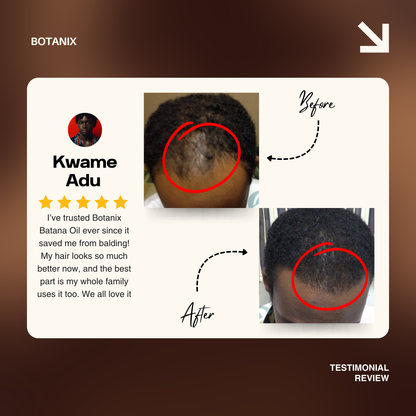 Batana Natural Hair Growth Oil