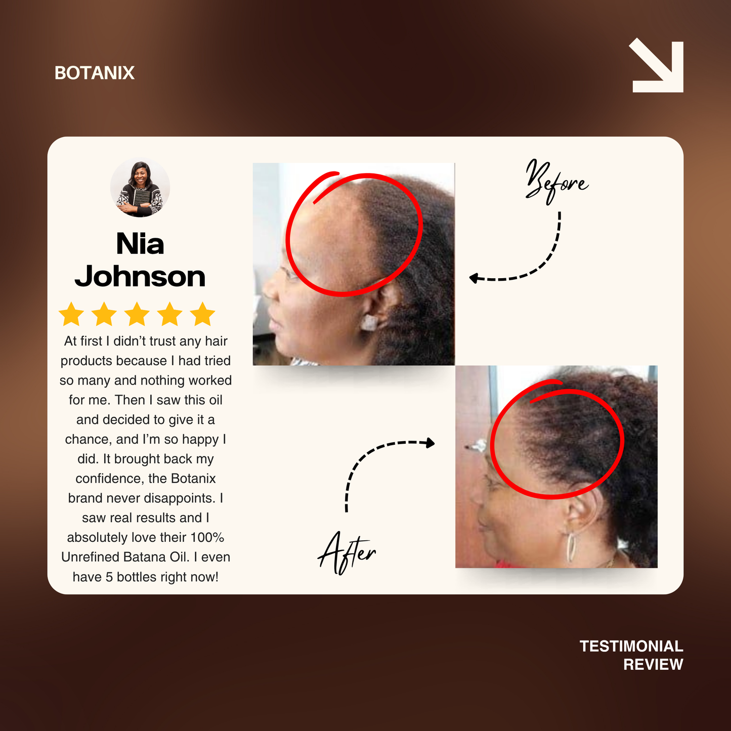 Batana Natural Hair Growth Oil