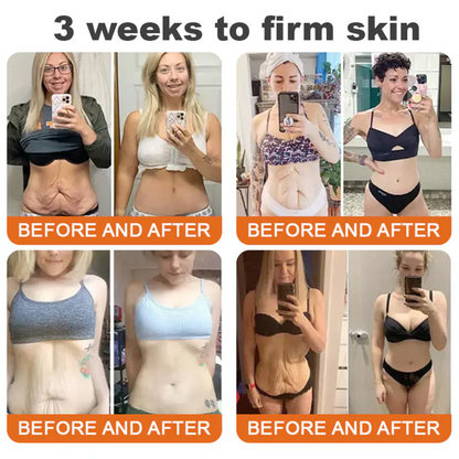 📦📦📦TGA Approved: Ourlyard® Bee venom Pro Comprehensive Cream — 🔥Limited Time 80% OFF🔥