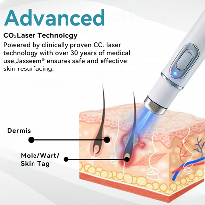 𝐉𝐚𝐬𝐬𝐞𝐞𝐦® Medical-Grade Laser Pen 🔥 (Powered by CO₂ laser technology – effectively removes moles, warts, skin tags, pigmentation spots, and other skin imperfections)🏆