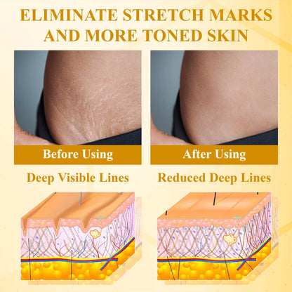 ApisDerm™ BotoxBee Advanced Multi-Action FirmingCream