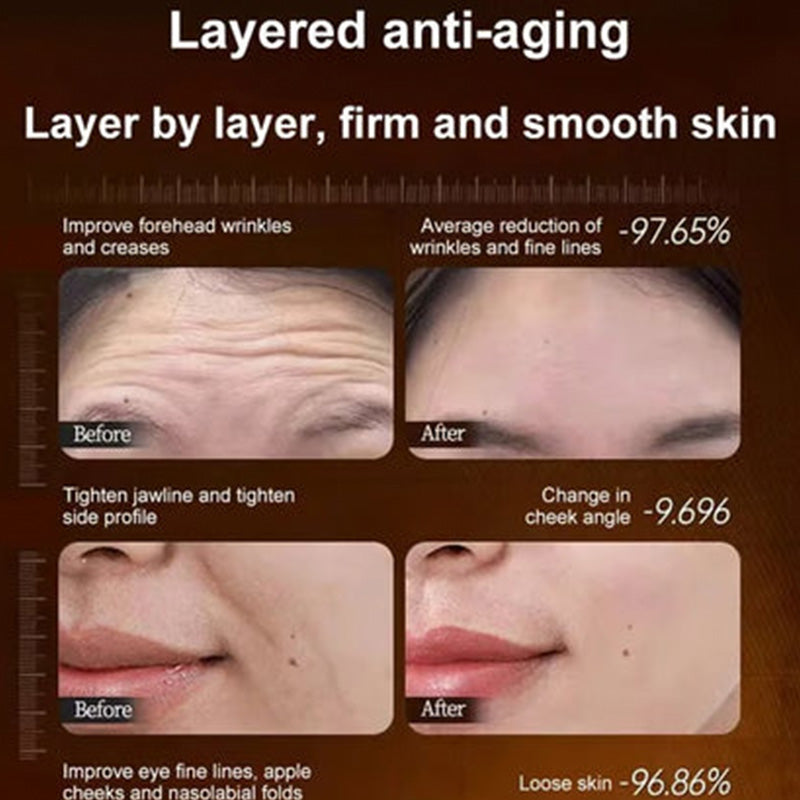 🌿【One touch to remove wrinkles】Micro-molecular collagen anti-wrinkle lotion